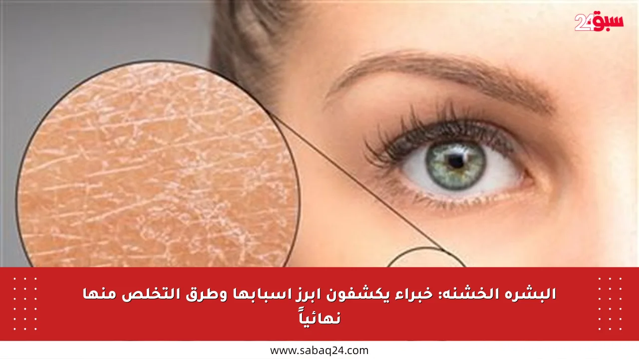 البشرة الخشنة: خبراء يكشفون أبرز أسبابها وطرق التخلص منها نهائياً
